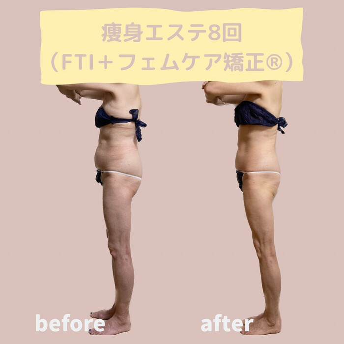 画像517
